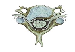 Bandscheibenvorfall an der Halswirbelsule