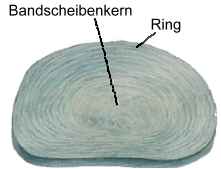 Gesunder Ring, gesunde Bandscheibe